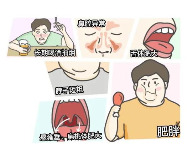 图片[11]-怎样的人容易打呼噜？这是一篇有声音的文章-万荀网